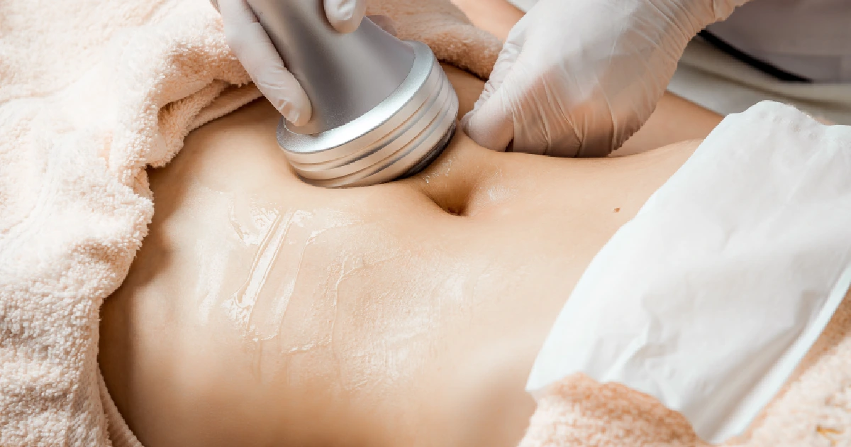 A woman receiving Body Contouring in Princeton ,WV