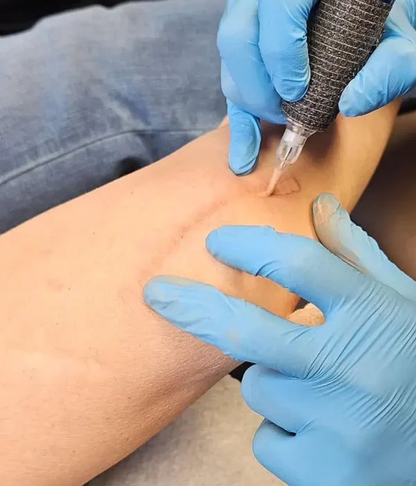 Paramedical Tattoo in Princeton, WV | Fit & Fabulous Spa